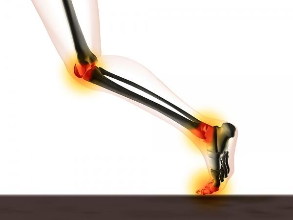 Домашното средство на баба срещу болки в ставите и мускулите