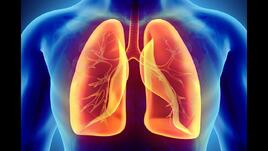 Храни с висок гликемичен индекс повишават риска от рак на белия дроб